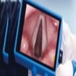 Flexible Video Laryngoscope